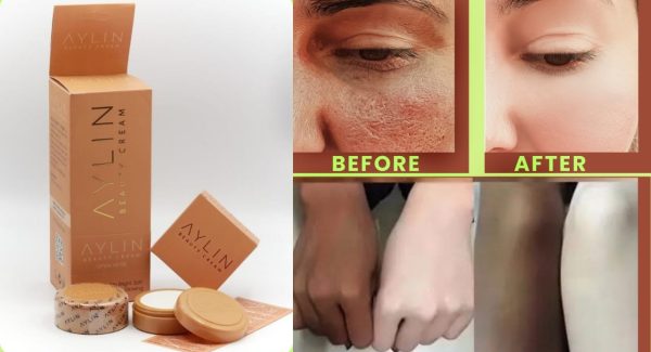 Aylin Beauty Cream Best Cream Ever | Best Quality Cream | Aylin Beauty Cream For Face Acne Pimples, & Blackheads | Whitening Cream ( Original )