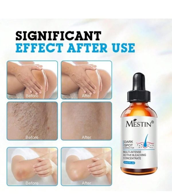 Mestin Anti-sun Spot Essence 30ml – Corrects Hyperpigmentation, Fades Dark Spots, Evens Skin Tone, 100% Natural Ingredients, Delays Aging
